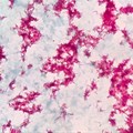 Mycobacterium tuberculosis under the microscope.