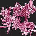 Electron micrograph of Mycobacterium tuberculosis bacteria, the cause of TB. Photo: NIAID via Flickr (CC BY 2.0)