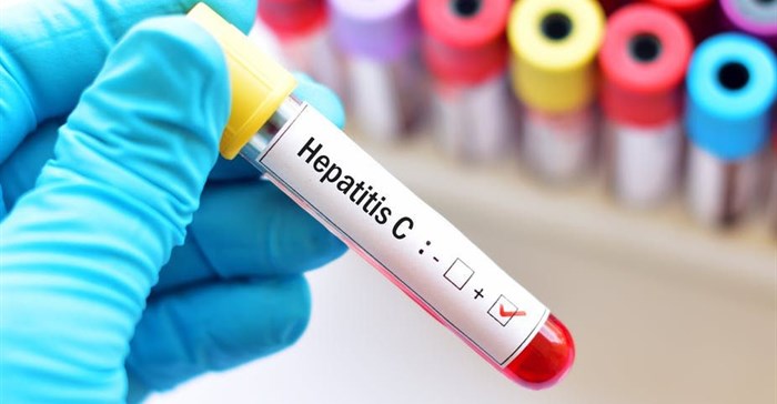 Hepatitis is a major public health burden. Shutterstock
