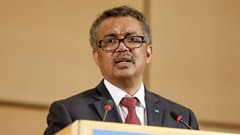 Tedros Ghebreyesus, embarrassed to only talk about Ebola. Salvatore Di Nolfi/EPA