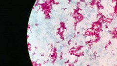 New TB vaccine shows promise