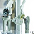 Low-cost alloys would pave the way for affordable medical implants and prosthetics. Monstar Studio/Shutterstock