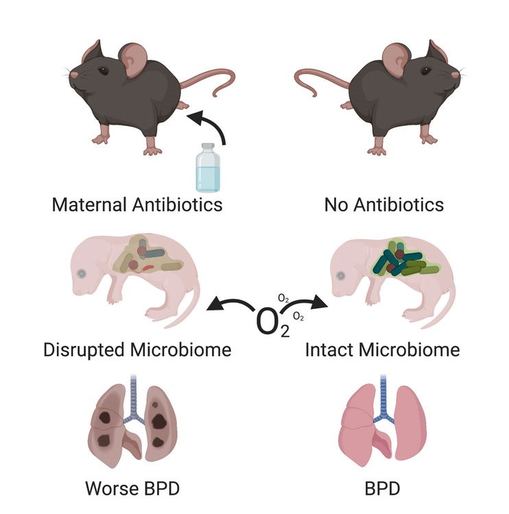 Giving antibiotics during pregnancy causes more severe lung damage in the pups. This figure created with the aid of BioRender. Kent Willis,