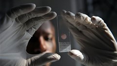 A laboratory technician prepares a sample at the government-run Ifakara Health Institute north of Tanzanian capital Dar es Salaam. PHOTO Tony Karumba/AFP via Getty Images
