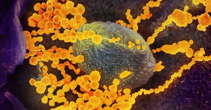 This electron microscope image shows SARS-CoV-2 (round gold objects) emerging from the surface of cells cultured in a lab. Image: NIAID-RML (CC BY 2.0)