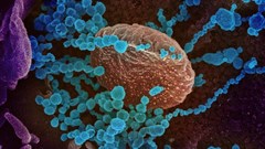 SARS-CoV-2, the virus that causes Covid-19 (round blue objects), emerging from the surface of cells cultured in the lab. Image by the US NIAID (CC BY 2.0)