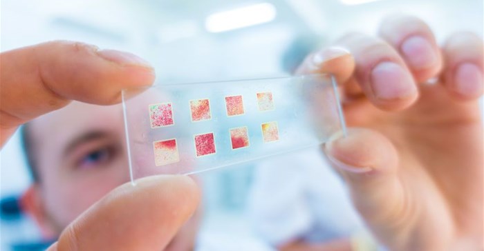 Study: Dried blood spot sampling provides greater access to antibody testing