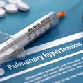 Conditions like HIV, TB, and chronic obstructive pulmonary disease increase the risk of pulmonary hypertension. Shutterstock