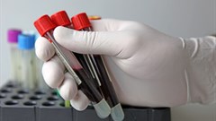 Here's where efforts to end HIV in eastern and southern Africa must focus