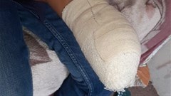 Labour department acts against Queenstown factory where worker's hand was severed