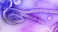 Source: public health image library/CDC (public domain).