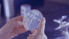 TB is once again the deadliest disease in Africa - what went wrong?