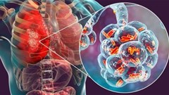 Source: Advin Healthcare.