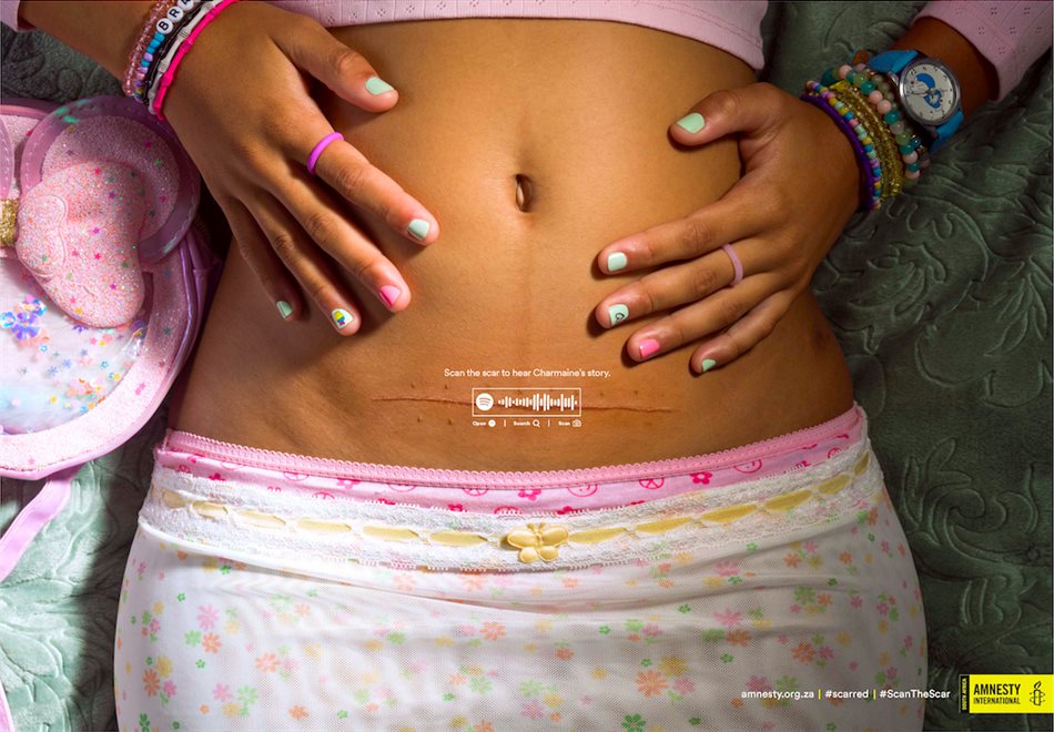 Amnesty International South Africa raises awareness about child and teenage pregnancy