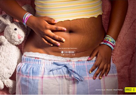 Amnesty International South Africa raises awareness about child and teenage pregnancy