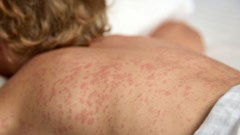 Image source: aleksandrfinch –