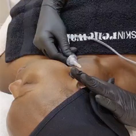 Are old-school cosmetic facelifts really your skin&#x2019;s best friend?