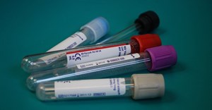 Image credit: Anna from Pixabay