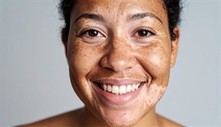 SA&#x2019;s world-first Chrome extension takes on harmful AI beauty standards